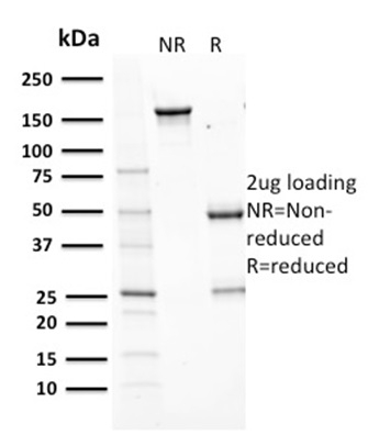 Data from SDS-PAGE analysis of Anti-Aurora B antibody (Clone AURKB/1593). Reducing lane (R) shows heavy and light chain fragments. NR lane shows intact antibody with expected MW of approximately 150 kDa. The data are consistent with a high purity, intact mAb.